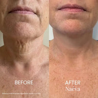 Naéva® Tighten & Lift Neck Cream