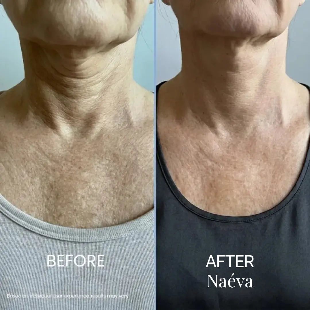 Naéva® Tighten & Lift Neck Cream
