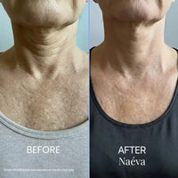 Naéva® Tighten & Lift Neck Cream