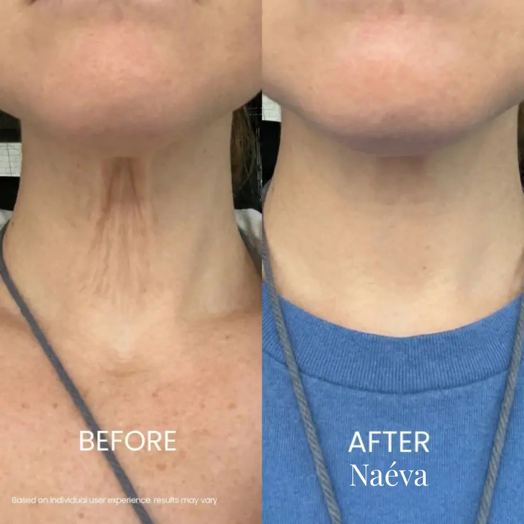 Naéva® Tighten & Lift Neck Cream
