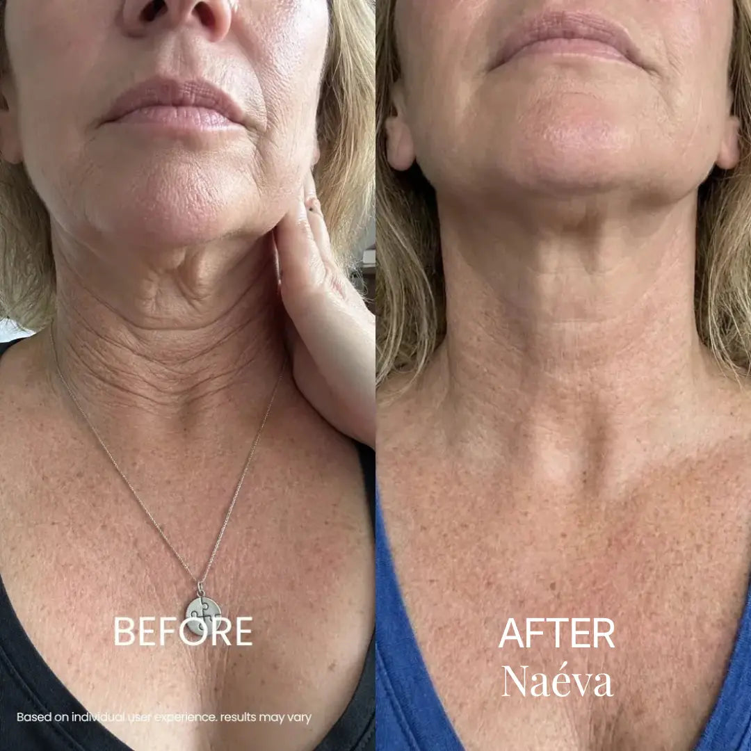 Naéva® Tighten & Lift Neck Cream